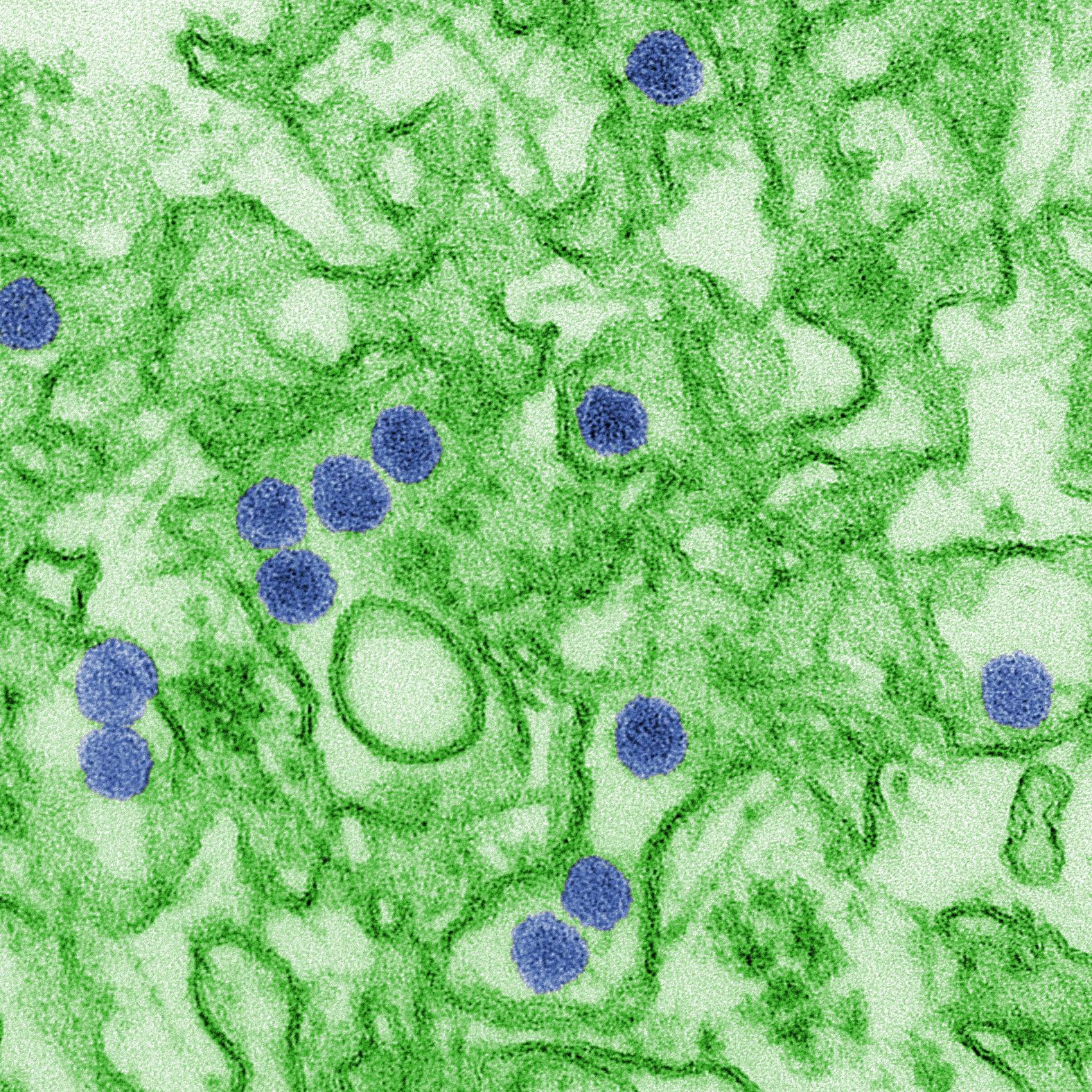 This is a digitally-colorized transmission electron microscopic (TEM) image of Zika virus, which is a member of the family Flaviviridae. Virus particles, here colored red, are 40 nm in diameter, with an outer envelope, and an inner dense core.